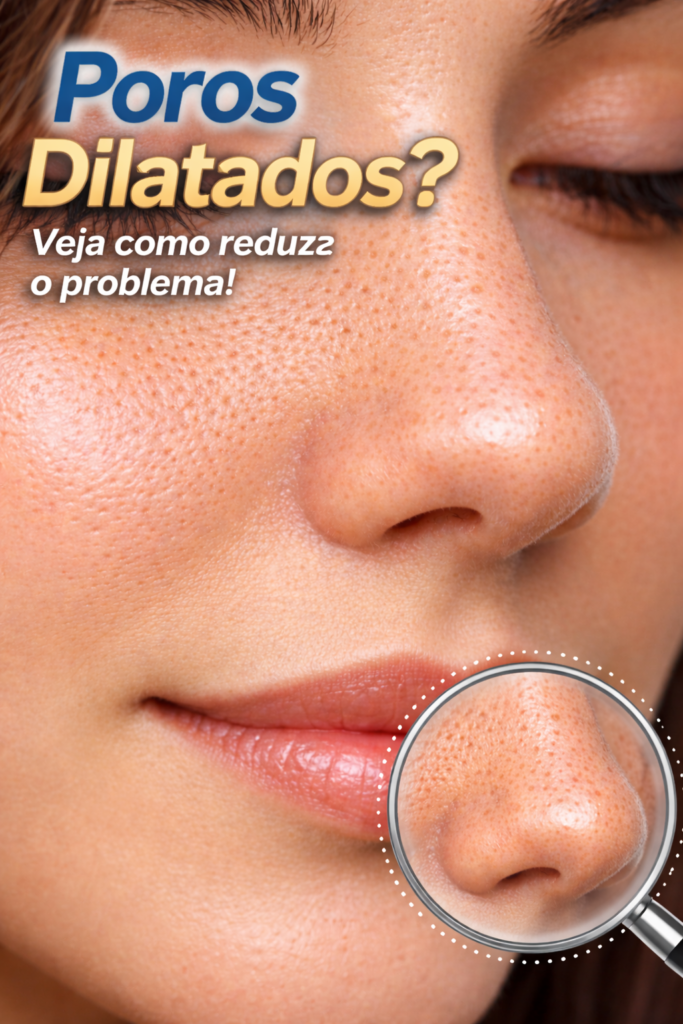 Poros dilatados no rosto feminino – veja como diminuir poros