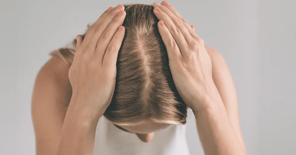 Visão aproximada do couro cabeludo com sinais de oleosidade e queda de cabelo feminina.