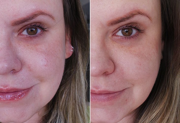 Principia Niacinamida antes e depois redução de poros e melhoria de textura na pele.